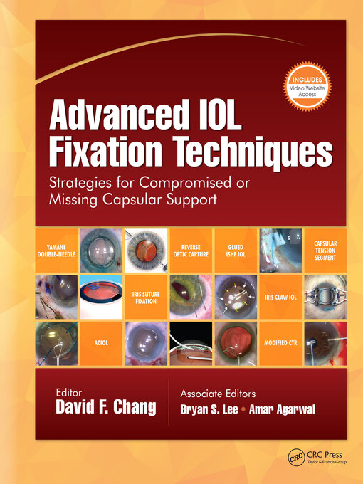 Title details for Advanced IOL Fixation Techniques by David F. Chang - Wait list
